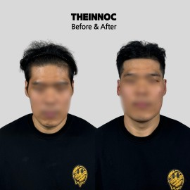 누구보다 자연스러운 풍성해보이는 헤어를 원한다면!인천두피커버 전문샵