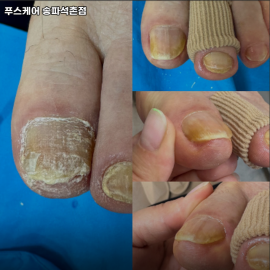 발은 가장 관리받아야 마땅한 신체부위입니다. 최선을 다 해 관리해드릴게요.