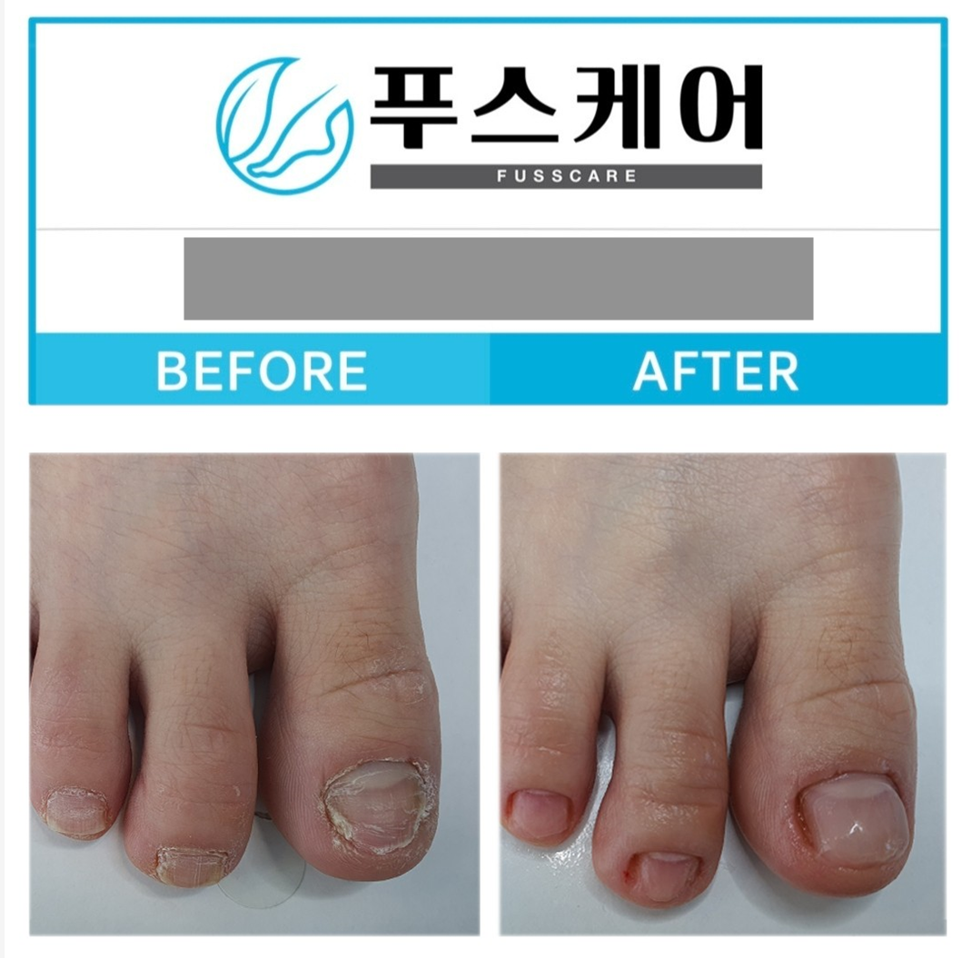 [경기 남양주]발은 가장 관리받아야 마땅한 신체부위입니다. 최선을 다 해 관리해드릴게요. 
