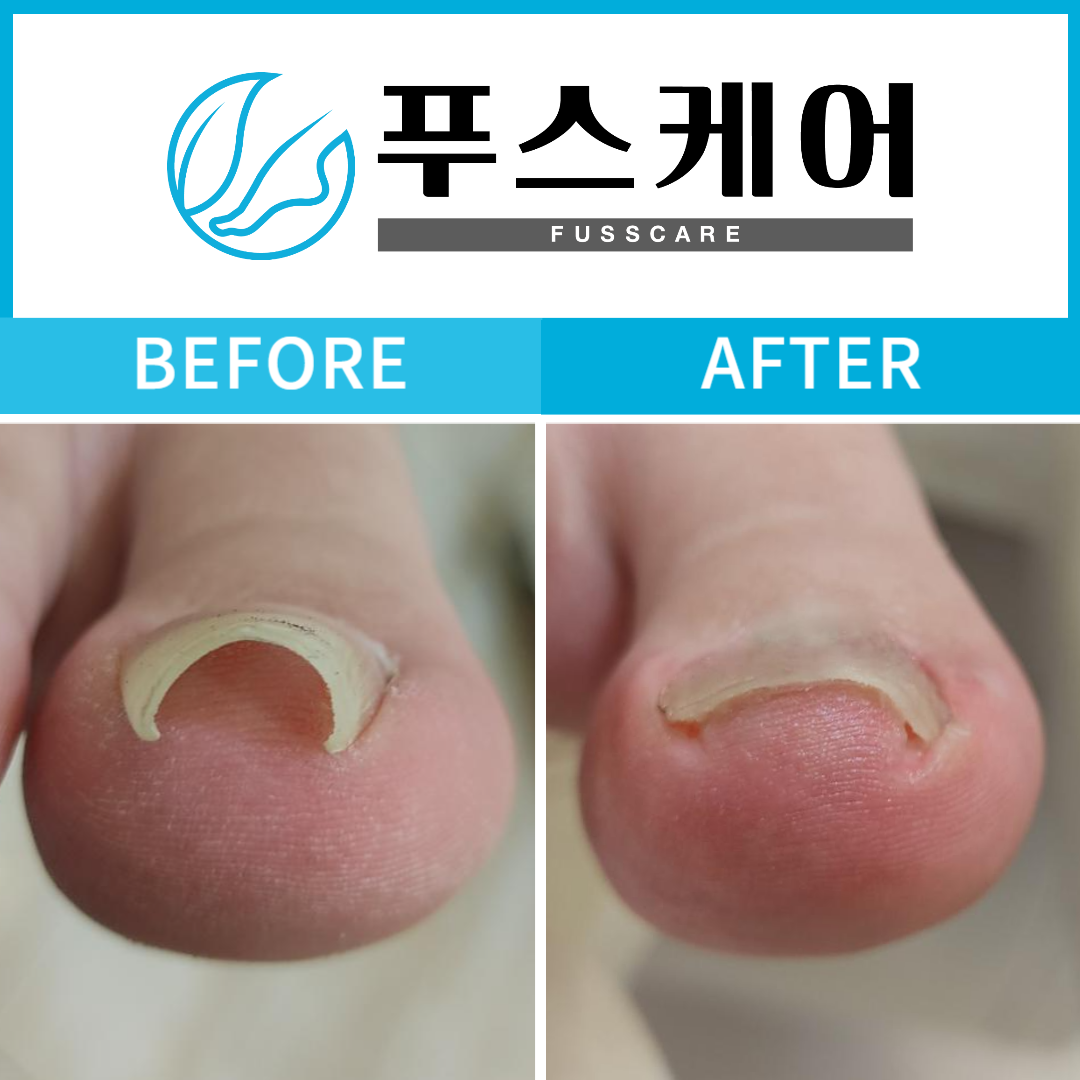 [서울 동대문]푸스케어 지점 중 단연코 1위 지점! [푸스케어 청량리역점]
