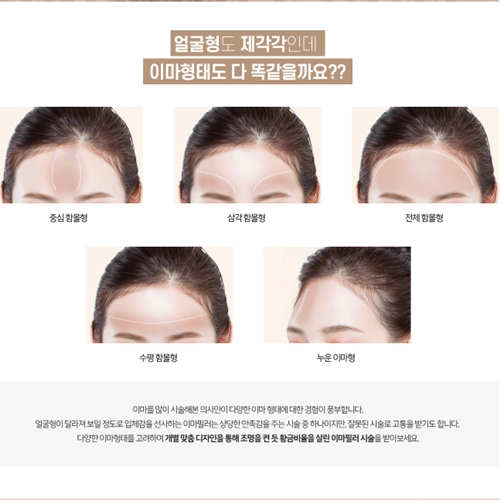 [서울 강남]강남에서 필러 제일 잘하는집! 원하시는 필러 체험하세요! 원료부터 다른 1대1