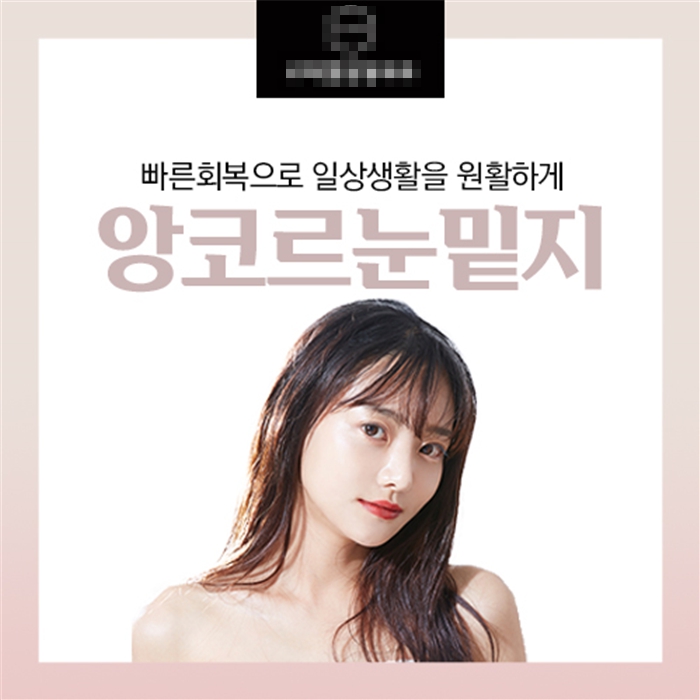 [서울 종로]앙코르눈밑지★ 흉터가 겉으로 안보이는 최신레이저 장비! 일상생활 즉시 가능!