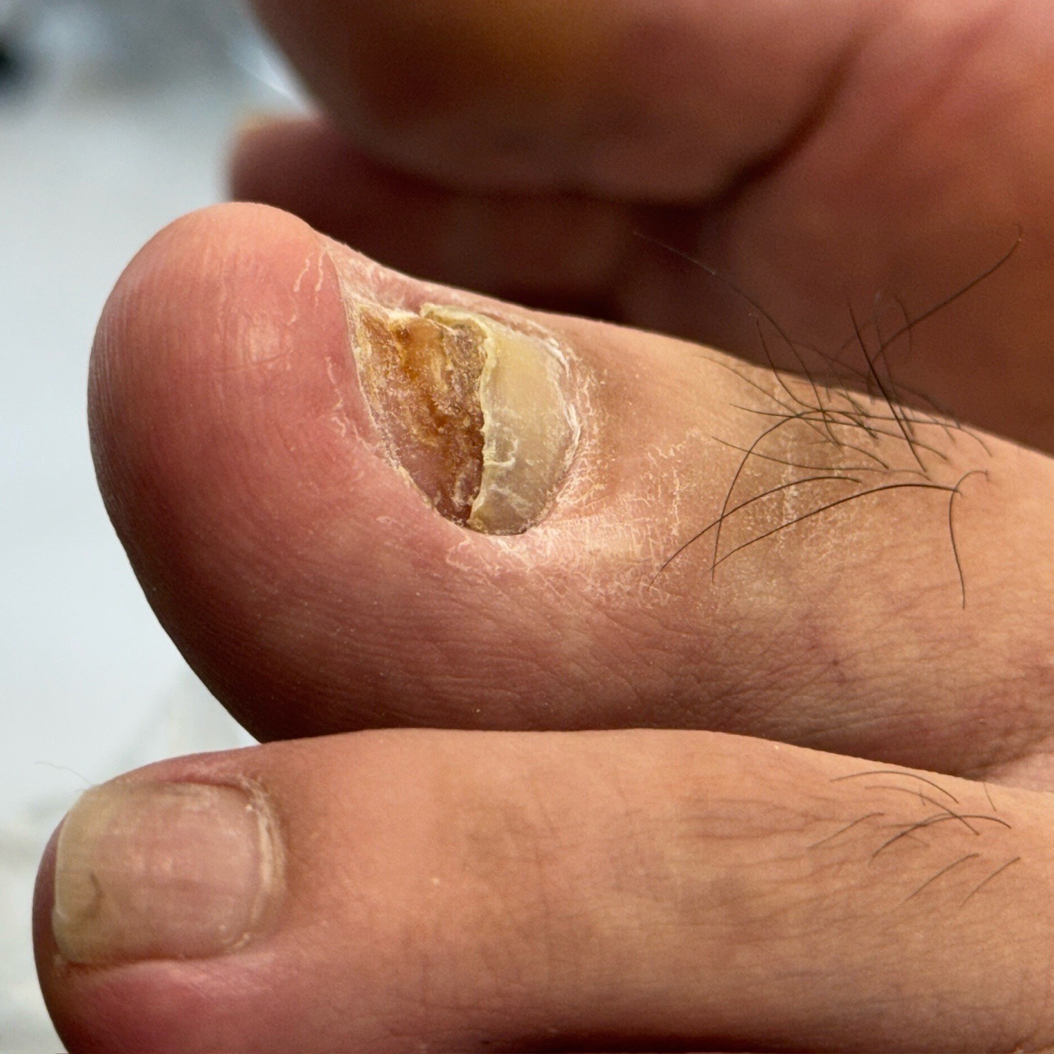 [서울 강남]기술력이 뛰어난 푸스케어 강남본점입니다 발관리 받아보세요. [푸스케어 강남본점